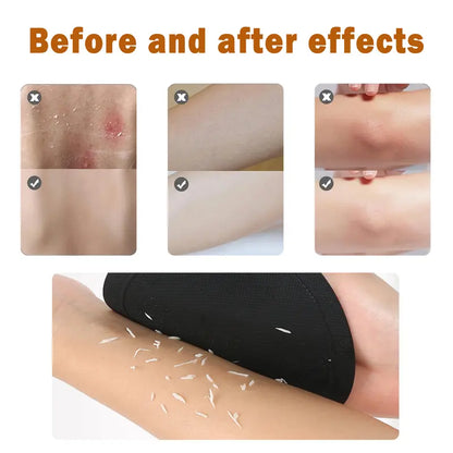 Soft Silicone Shower Scrubber – Gentle Exfoliating Body Brush (4-Pack)